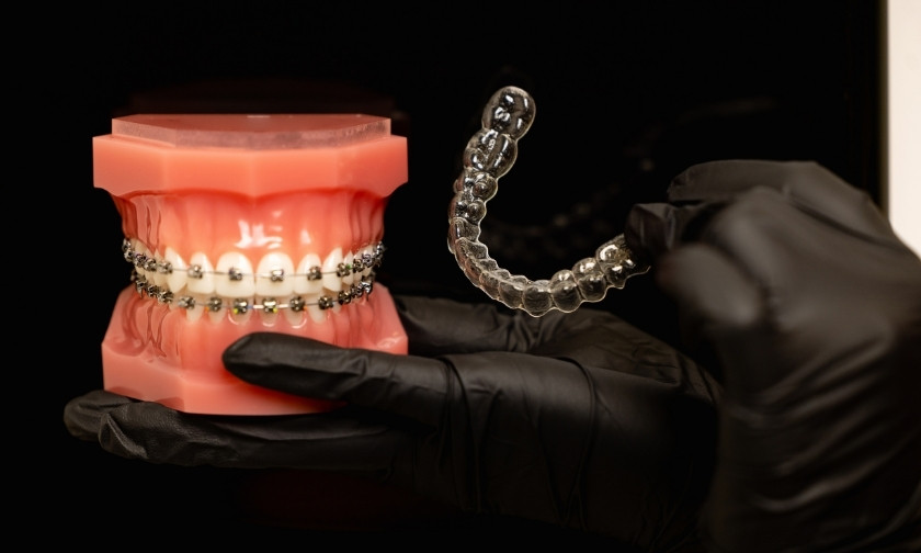 5 reasons you might need an emergency orthodontist